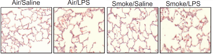 Chronic obstructive pulmonary disease (COPD) Models