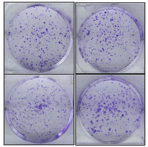 Clonogenic Assay