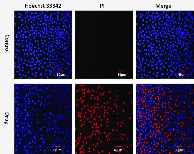 Hoechst 33342 and PI double staining in MCF-7 cells.