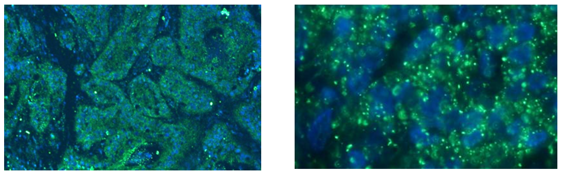 ESCC tumor FFPE slides. Green staining shows the expression of a specific miRNA
