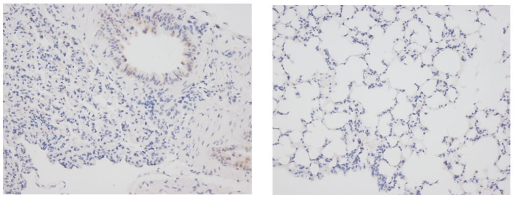 Mouse brain tissue slides. Brown DAB staining shows the expression of Ercc1 gene.