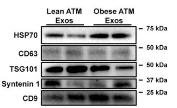 Exosome Antibodies