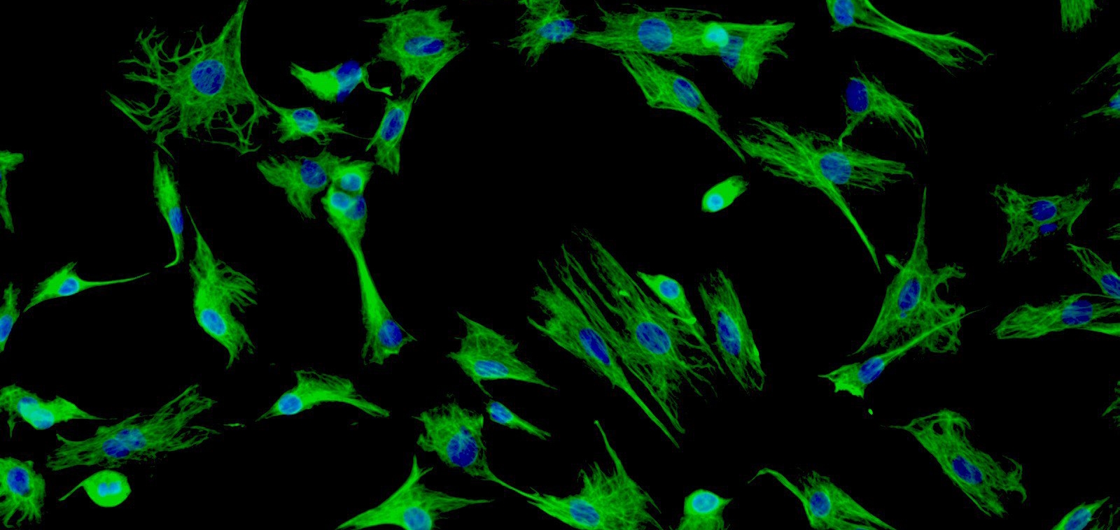 Fibroblast Cells And Media