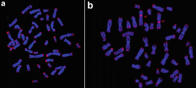 Human Telomere FISH Probe