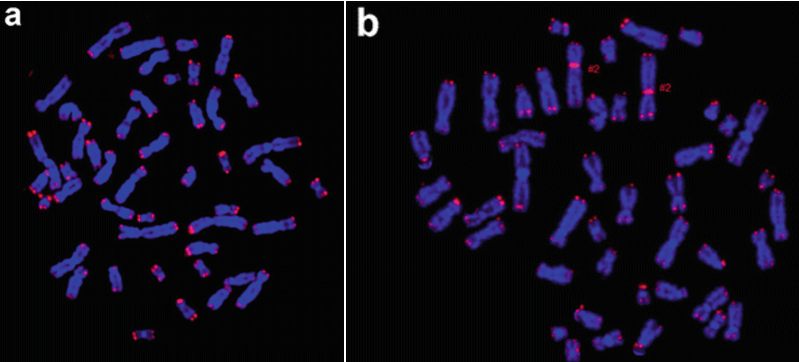 Human Telomere FISH Probe