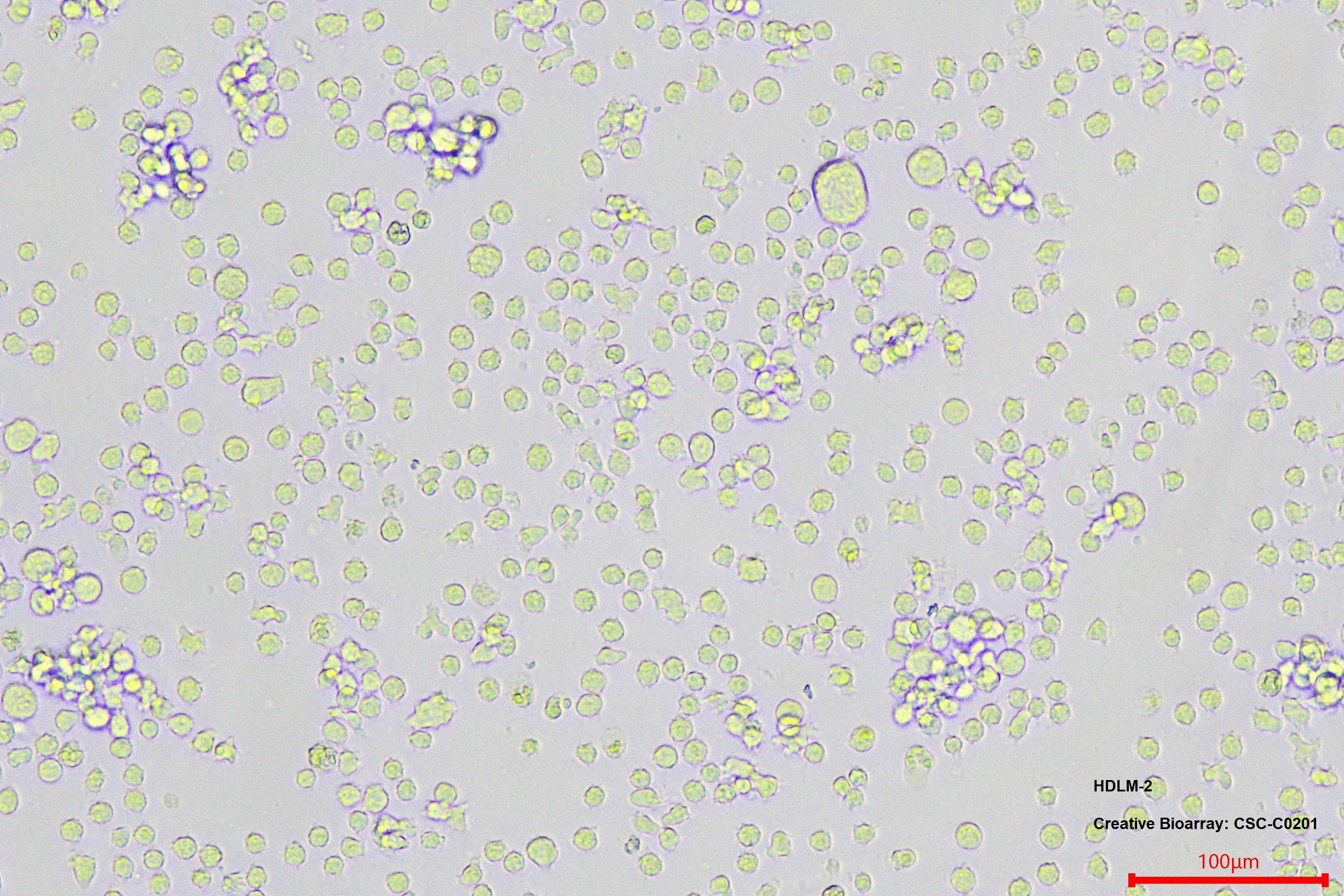 HDLM-2 STR DNA Profile