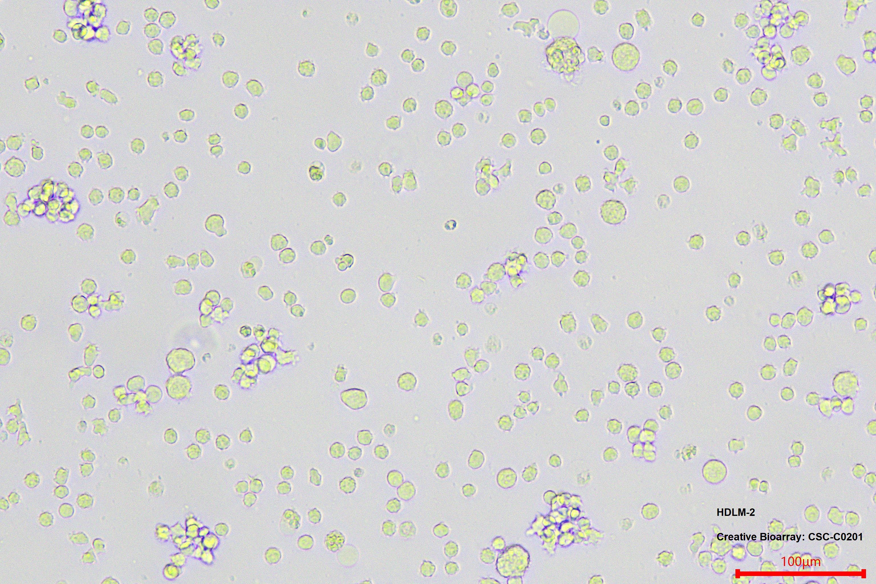 HDLM-2 STR DNA Profile