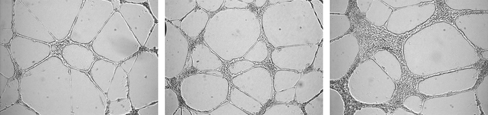 Effect of cell number on HUVECs tube formation