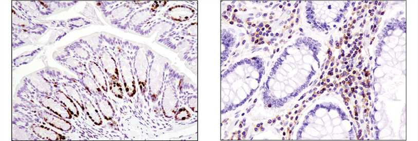 Immunohistochemistry Troubleshooting