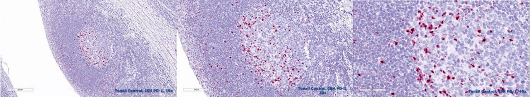 Tonsil tissue was stained with the PD-1 RNA ISH probe.