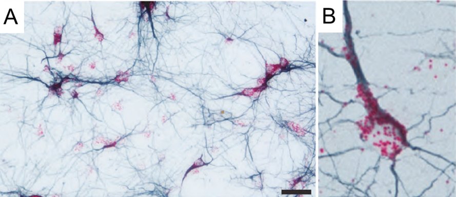 RNA ISH was combined with IHC to detect Tau ISH signal in neuronal cell bodies and processes labeled with tubulin by IHC.