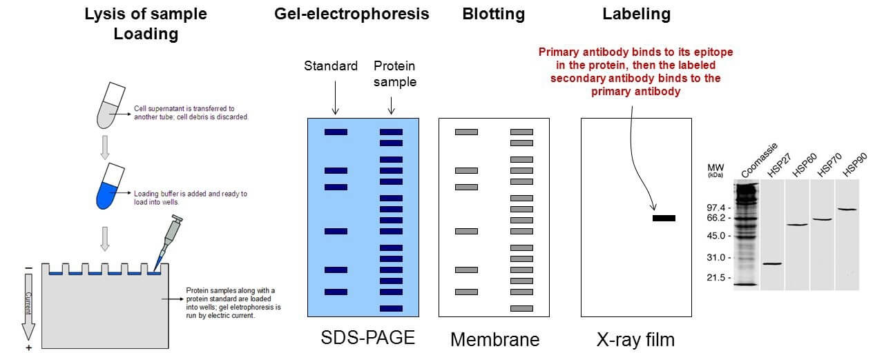 LATS Kinase Phosphorylation Assay by Immunoblotting