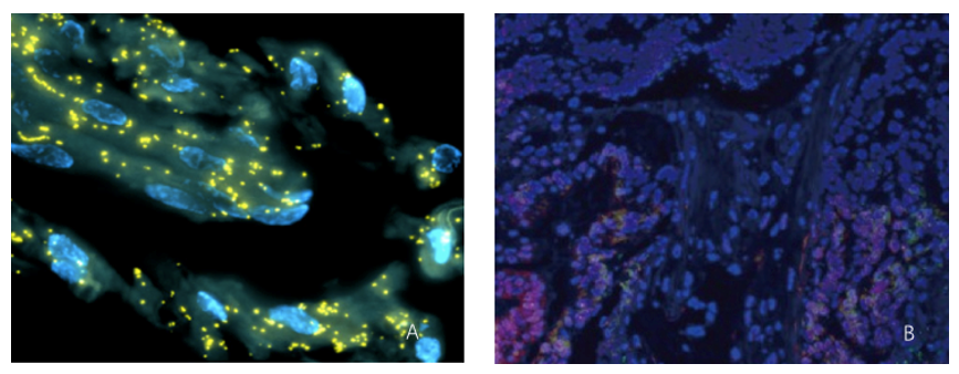 FISH Analysis of Microorganisms