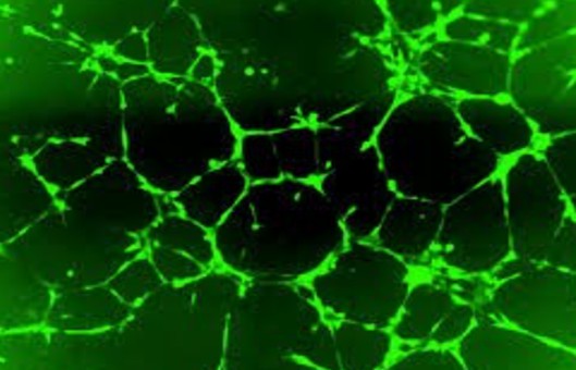 Cell Angiogenesis Assays