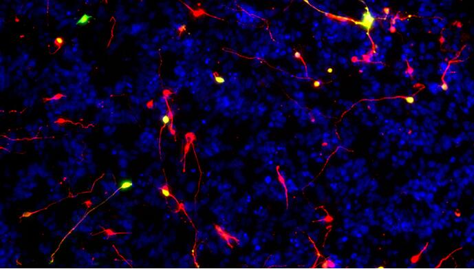 Neurite Outgrowth Assay Service