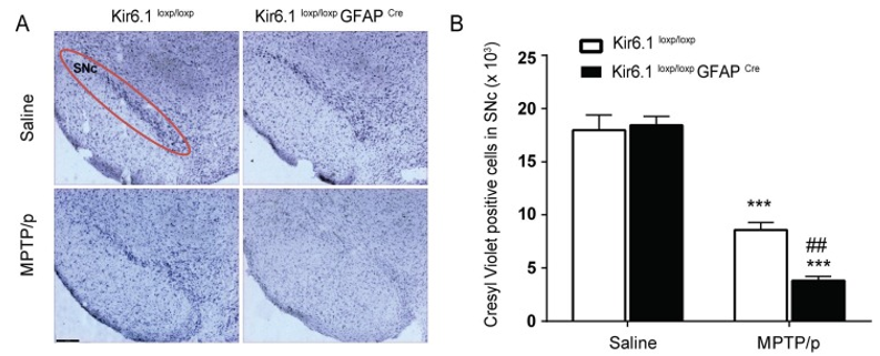 Neurological Disease Models