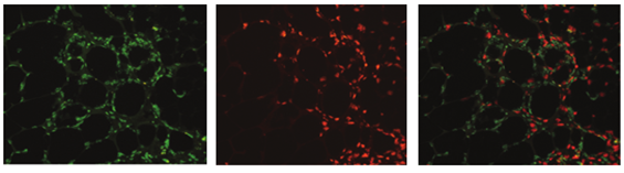 Human- and Mouse-Specific RNA Detection in Patient-Derived Xenografts (PDX)