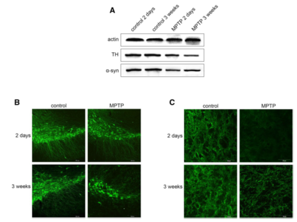 Parkinson's Disease Models