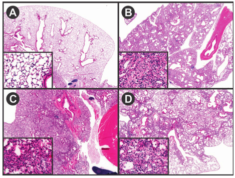 Pulmonary Fibrosis Models