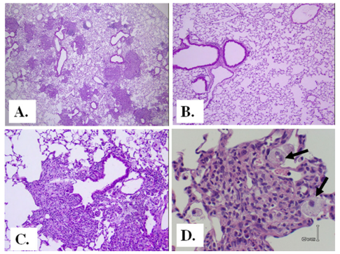 Pulmonary Fibrosis Models