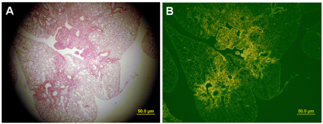 Pulmonary Fibrosis Models