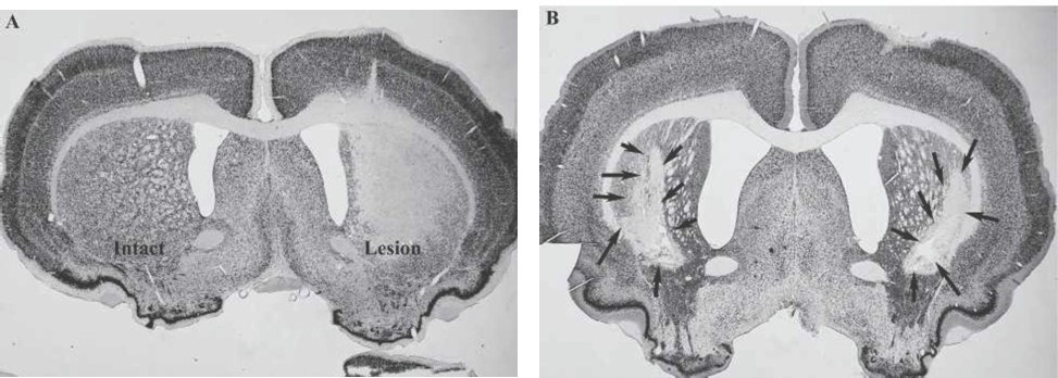 Rare Disease Models