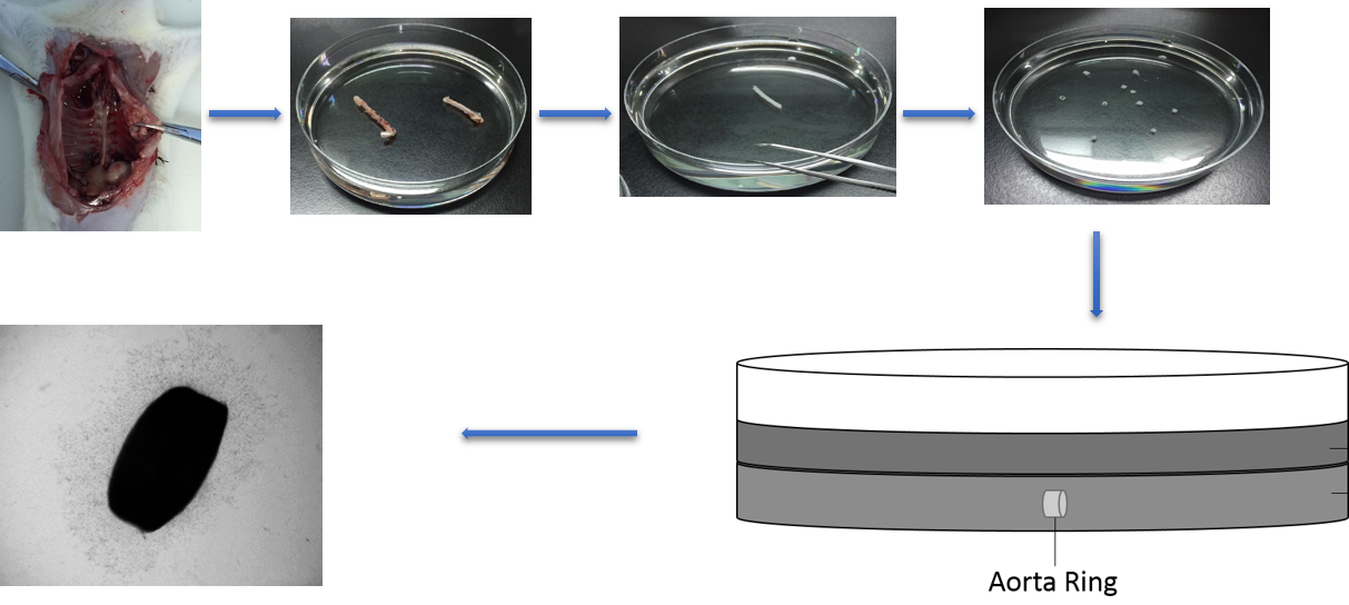 The workflow of rat aortic ring assay