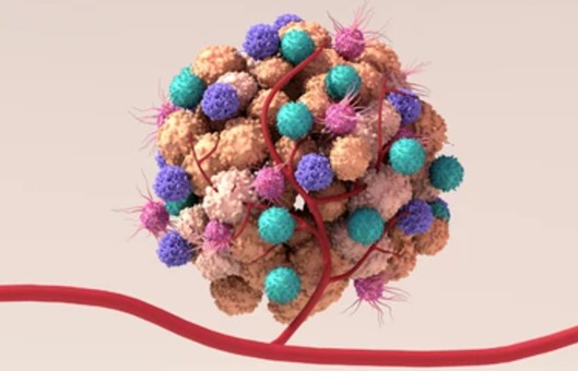 Breast Tumor Cells 