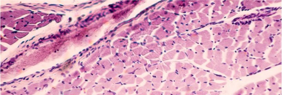 Skeletal Muscle Cells And Media