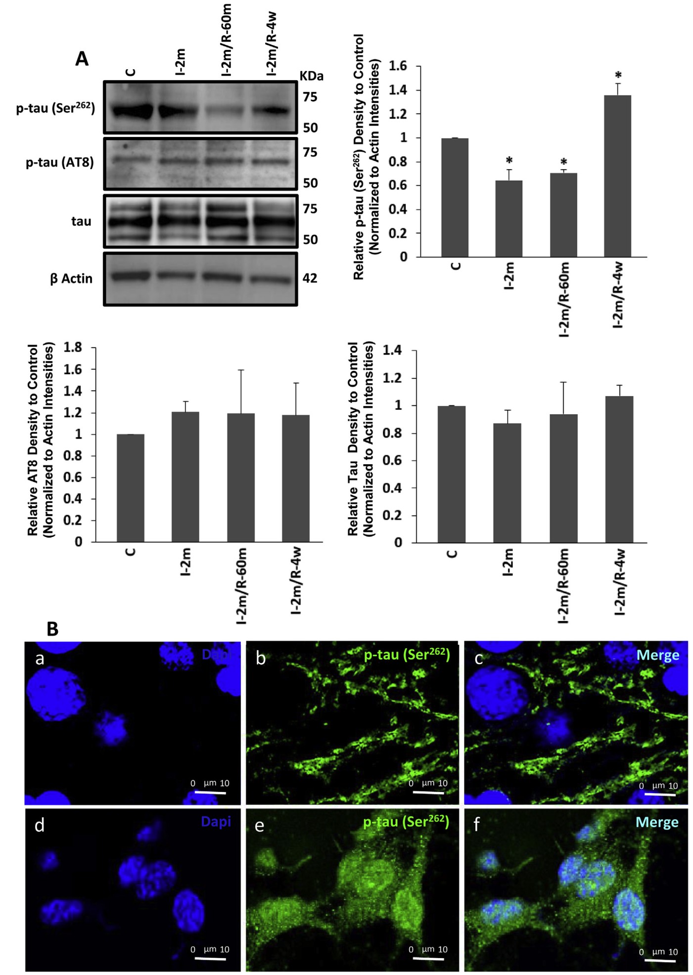 Tau Hyperphosphorylation Assay