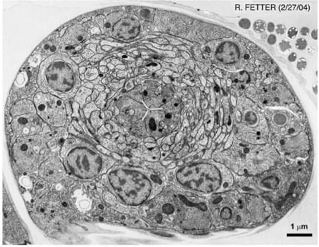 Transmission Electron Microscopy (TEM) Service