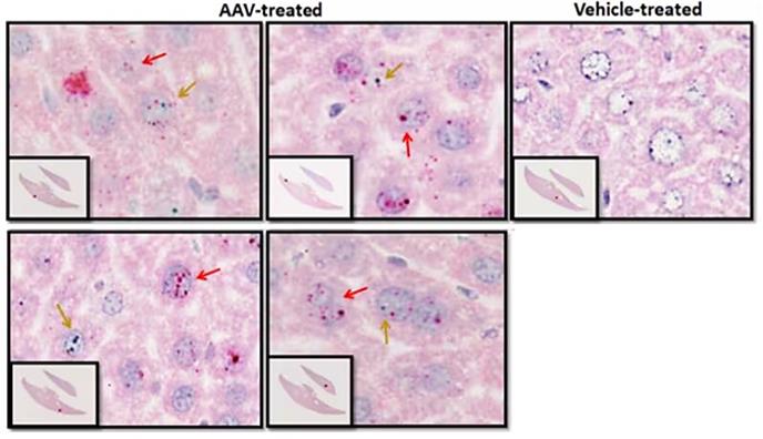 RNAscope probe staining allows visualization and quantification of transgene expression (red arrow) and AAV vector (green arrow) presence in treated liver samples.