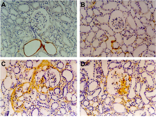 Fibronectin immunostaining in renal cortex from the groups: Control (A), LMWH (B), PAN (C), and PAN+LMWH (D) (magnification 400). 