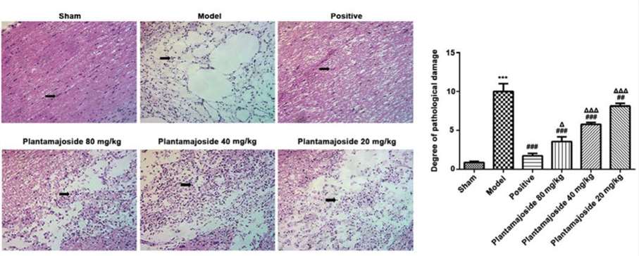 Fig. 3 Plantamajoside alleviates the pathological morphology of the spinal cord in rats