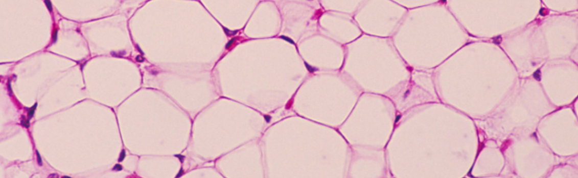 Adipose Cells