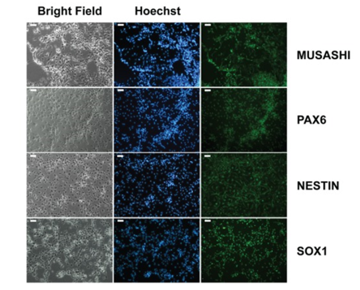 Immunocytochemical analysis of neural stem cells. Scale bar is 50μm.