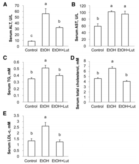 Serum concentrations of ALT (A), AST (B), TGs (C), total cholesterol (D), and LDL cholesterol (E) in male mice fed a control diet or an ethanol-containing diet with or without luteolin for 2 wk.