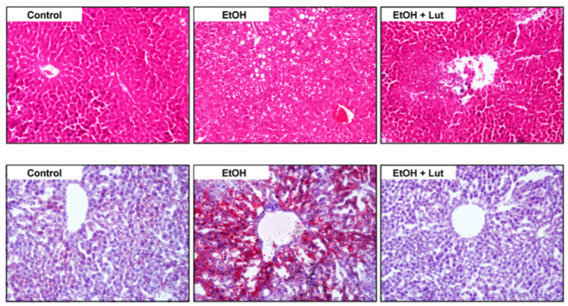 Hematoxylin and eosin staining and Oil-Red-O staining