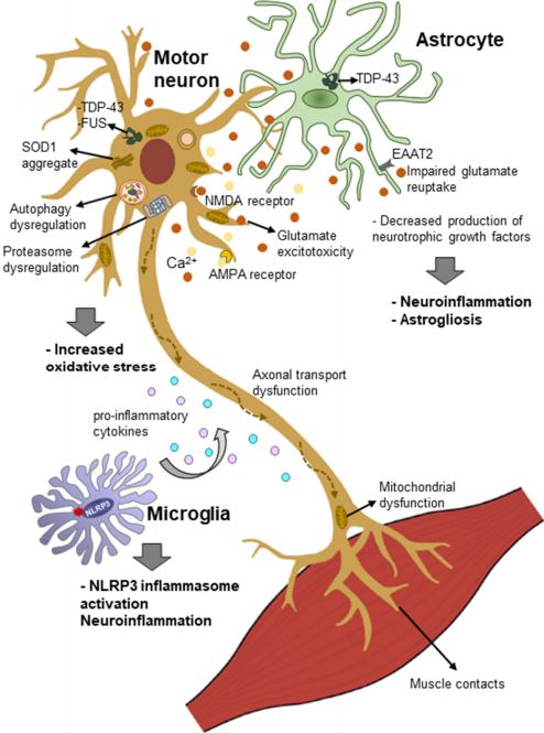Fig. 1 Proposed mechanisms of the pathogenesis of amyotrophic lateral sclerosis (ALS)