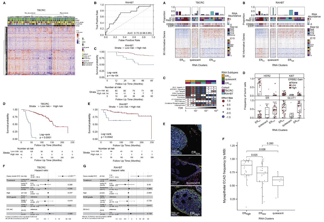 Left: Identification, training, and validation of 812-gene classifier; Right: Transcriptomic DCIS subtypes correlate with outcome pathways.