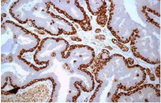 Immunohistochemistry (IHC) and Immunofluorescence (IF)