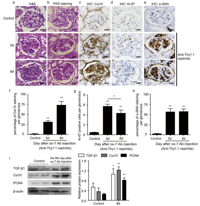 Rat anti-Thy1.1 nephritis model was induced by ox-7 antibody. 