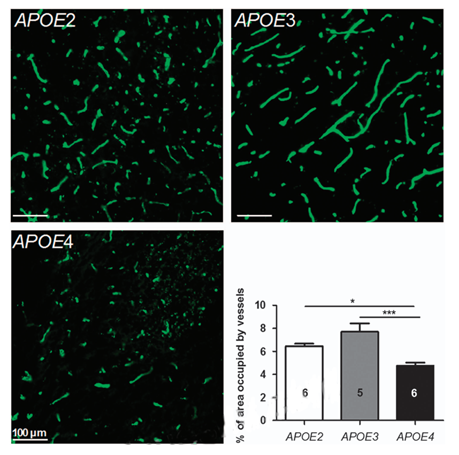 Relative vessel density in the hippocampus was reduced in APOE4 mice. Area occupied by vessels was determined by immunohistofluorescence using anti-collagen IV antibody in 12-month-old APOE2, APOE3, and APOE4 mice. Image analyses were performed in the CA2-CA3 region of hippocampal slices located between bregma - 1.46 and bregma - 1.70. Data are shown as mean ± standard error of the mean (s.e.m.). Statistical analyses: one-way analysis of variance (ANOVA) followed by Dunnett’s multiple comparison test. *P<0.05; ***P<0.001 (n = 5 to 6). 