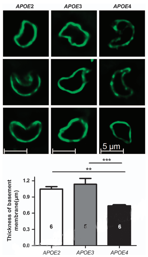 The apparent thickness of the basement membrane of brain capillaries (μm) was reduced in APOE4 mice, as assessed using immunohistofluorescence with an anti-collagen IV antibody in 12-month-old APOE2, APOE3, and APOE4 mice. Data are shown as mean thickness ± standard error of the mean (s.e.m.). Statistical analyses: one-way analysis of variance (ANOVA) followed by Dunnett’s multiple comparison test. **P<0.01; ***P<0.001 (n = 5 to 6). 