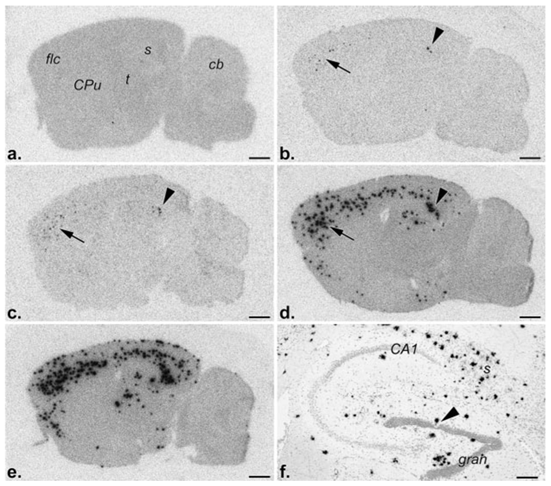 Fibrillar Aβ deposits, i.e., diffuse and mature plaques, revealed by in vitro binding of monomeric 125I-Aβ1– 40 to parasagittal brain sections followed by film radioautography. a, Nontransgenic control; 5 (b)-, 9 (c)-, 13 (d)-, and 17 (e)-month old PS2APP transgenic mice, respectively. Note the absence of deposits, i.e., binding, in the control, rare deposits in the subiculum (arrowhead) and frontolateral cortex (arrow) of a 5-month-old mouse, and their gradual, age-related increase in number and distribution at subsequent time points. f, Emulsion radioautography of a radiolabeled brain section of a 17-month-old mouse revealing the cellular distribution of Aβ deposits (black silver grains) in the hippocampal formation. Note, inter alia, the markedly reduced number of granule cells (arrowhead) in the vicinity of one cluster of silver grains, i.e., plaque. CA1, Ammon’s horn layer 1; cb, cerebellum; CPu, caudate putamen; gran, dentate gyrus granule cell layer; flc, frontolateral cortex; s, subiculum; t, thalamus. Scale bars:a–e, 1 mm; f, 200 µm. 