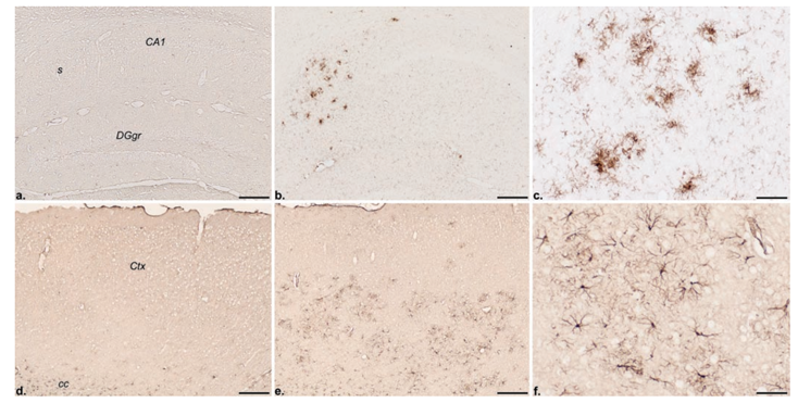Immunohistochemical localization of the inflammatory response markers CD45 (a–c) and GFAP (d–f ) in the hippocampal formation and frontolateral cortex, respectively, of a nontransgenic control (a, d) and a 13-month-old PS2APP transgenic mouse (b, c, e, f ). Note the absence of CD45 and GFAP immunoreactivities, i.e., microglioses and astroglioses, respectively, in the control but their discrete localization in the transgenic brain. CA1, Ammon’s horn layer 1; cc, corpus callosum; Ctx, neocortex; DGgr, dentate gyrus granular layer; s, subiculum. Scale bars: a, b, d, e, 200 µm; c, f, 50 µm. 