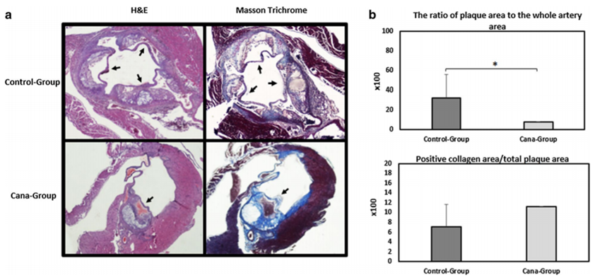 Atherosclerotic plaque extension among APOE(−/−) mice on western diet treated with canaglifozin (Cana-group) or vehicle (control-group). a Selected 4 μm section images from the aortic root stained with H&E and Masson trichrome. Formation of atherosclerotic plaque was examined using H&E staining while histological examination of atherosclerotic plaque collagen content was assessed using Masson trichrome staining. b Quantifcation of plaque area is shown as a percentage of lumina stenosis by thickened intima. Collagen content was measured using quantifcation of Masson trichrome positive area over complete plaque area. 