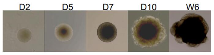 Phase contrast images taken after differentiation, showing the morphological changes occurred.