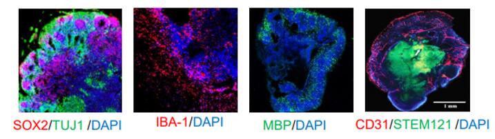 Differentiation of different types of brain organoids.