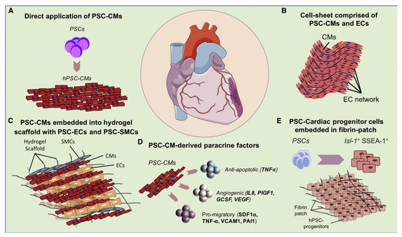 Cardiac Cell Therapy Using PSC-CMs.
